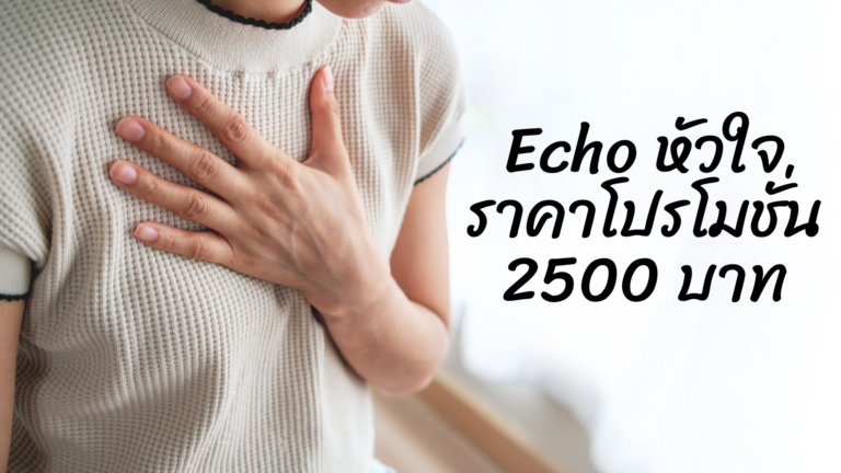 Echo ราคาโปรโมชั่น
